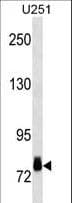 RPS6KA3 / RSK2 Antibody