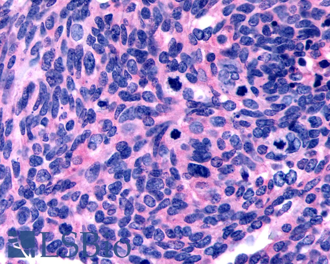 PathPlus™ Polyclonal Rabbit anti-Human OXTR / Oxytocin Receptor Antibody (N-Terminus, IHC)