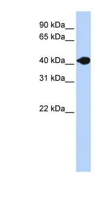 Polyclonal Rabbit anti-Human DNASE2B Antibody (aa36-85, WB)