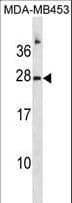 IHC-plus™ Ribonuclease A / RNASE1 Antibody (aa14-42)