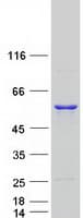 Human UAP1 Protein (Recombinant Myc-DDK (Flag))