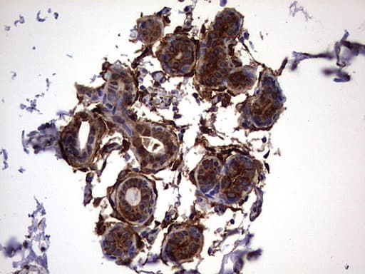 LGALS3 / Galectin 3 Antibody (clone OTI1C7)