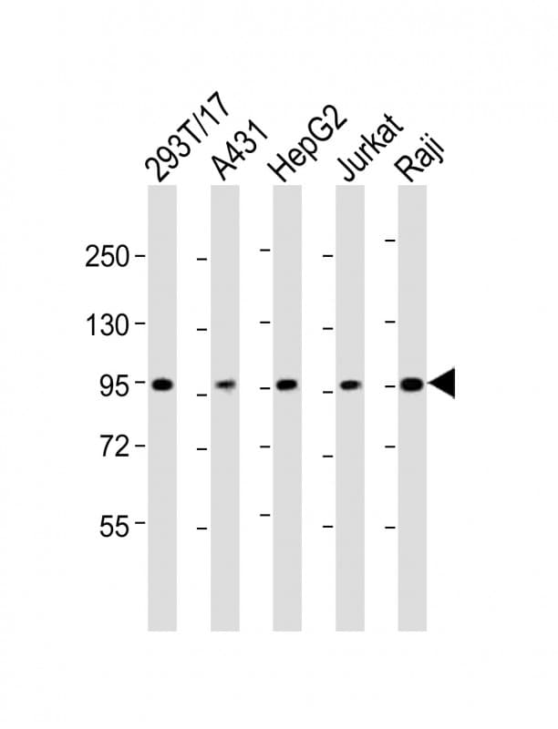 SLC22A2 Antibody (aa57-89)