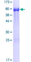 Human NOXA1 Protein (Recombinant GST)