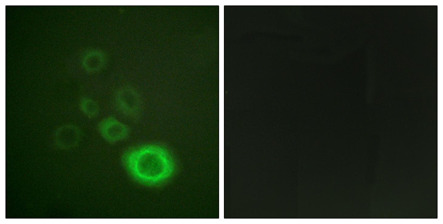 Polyclonal Rabbit anti-Human c-Met Antibody (aa976-1025, IF, WB)