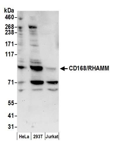 HMMR / CD168 / RHAMM Antibody (aa25-75)