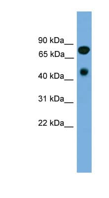 RIP4 / ANKRD3 Antibody (aa179-228)