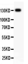 Polyclonal Rabbit anti-Human ITGB1 / Integrin Beta 1 / CD29 Antibody (aa527-728, IHC, WB)