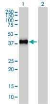 Monoclonal Mouse anti-Human GRAP2 / GRID Antibody (clone 1G12, IHC, WB)