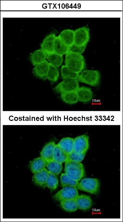 RGS17 / RGSZ2 Antibody (aa148-210)