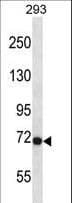 FGFR3 Antibody (aa468-495)