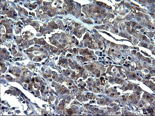 GCLC Antibody (clone OTI1A3)