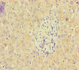PAN2 / USP52 Antibody