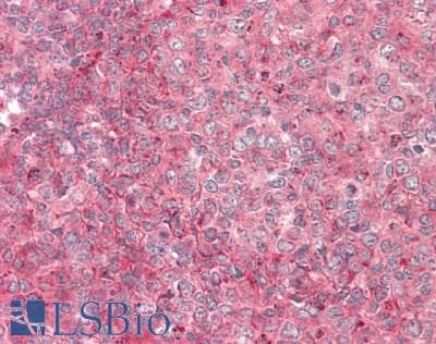 IHC-plus™ Polyclonal Rabbit anti-Human Ras (H, K, N) Antibody (aa1-50, IHC, WB)