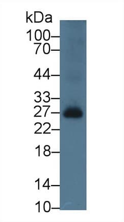 BAFF Receptor / CD268 Antibody (aa21-169)