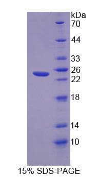 Human FLRT1 Protein (Recombinant His, N-Terminal)