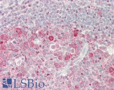 IHC-plus™ Polyclonal Rabbit anti-Human ASNS Antibody (IHC, IF, WB)