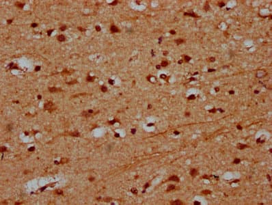 Polyclonal Rabbit anti-Human PRDM11 Antibody (IHC, IF, WB)