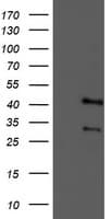 TMOD1 / Tropomodulin 1 Antibody (clone OTI2C2)