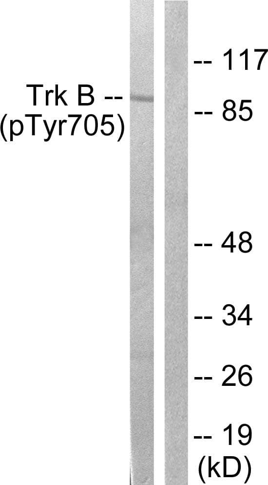 NTRK2 / TRKB Antibody (phospho-Tyr705)