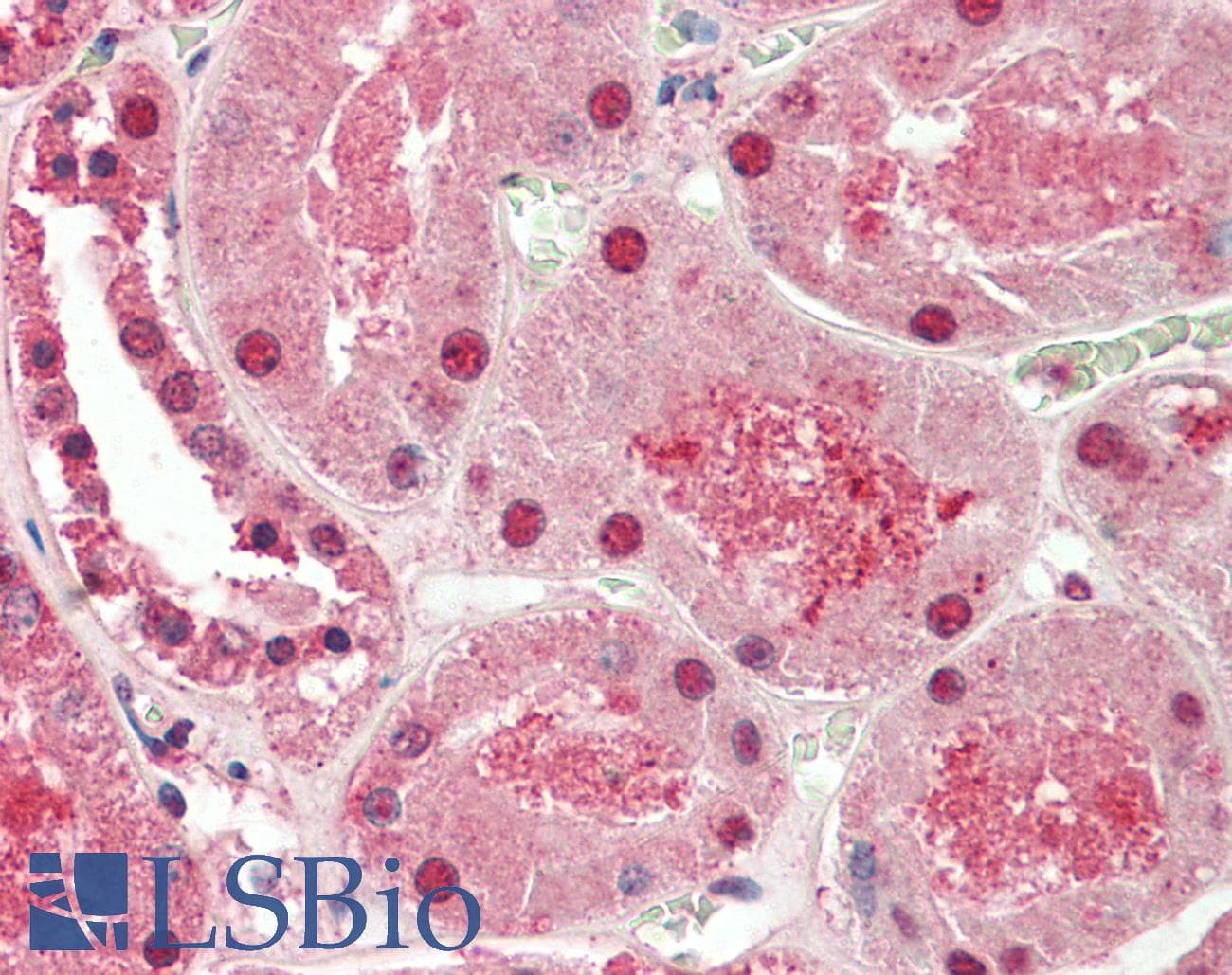 ST8SIA2 / STX Antibody (aa295-344)