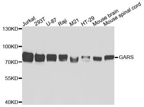 IHC-plus™ Polyclonal Rabbit anti-Human GARS / Glycyl tRNA Synthetase Antibody (IHC, IF, WB)