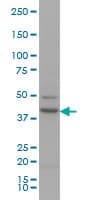 IHC-plus™ AML1 / RUNX1 Antibody (clone 2C10)