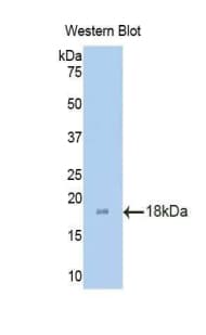 ADAMTS1 Antibody (aa476-614, Biotin)