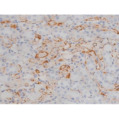 MAPT / Tau Antibody (phospho-Ser214)
