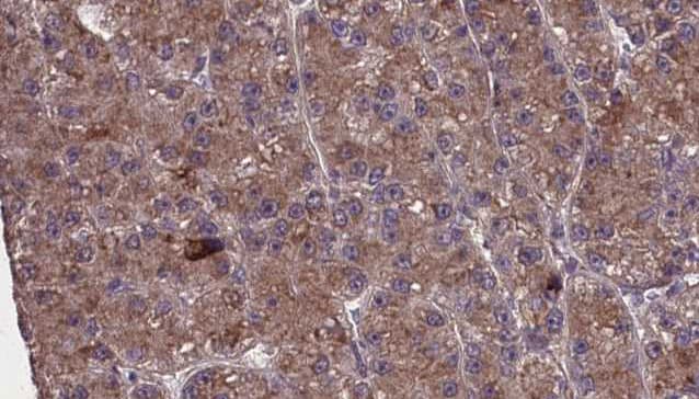 OR2M4 Antibody