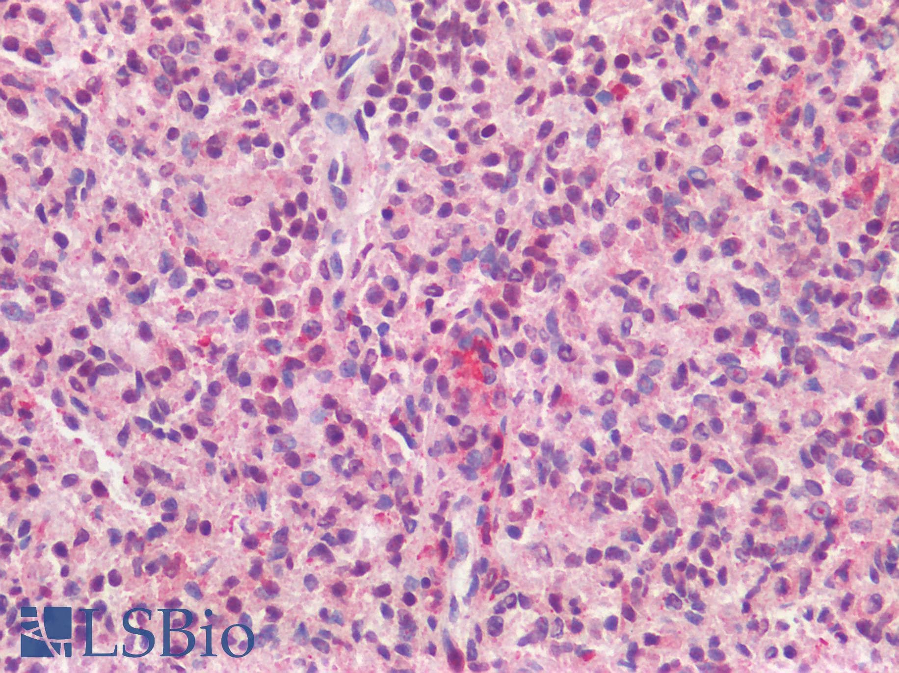 IHC-plus™ AIF1 / IBA1 Antibody (C-Terminus)