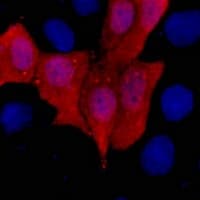 His Tag Antibody