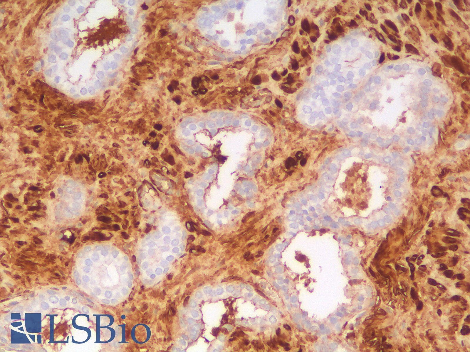 IHC-plus™ Recombinant Monoclonal Rabbit anti-Human CALD1 / Caldesmon Antibody (clone CALD1/1424R, IHC)