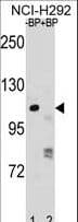 Polyclonal Rabbit anti-Human PARP1 Antibody (aa123-151, WB)