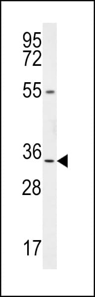 LRRC18 Antibody (aa149-177)