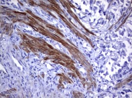 Monoclonal Mouse anti-Human CD30 Antibody (clone OTI9H7, IHC, WB)