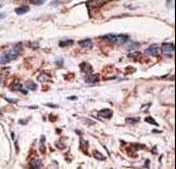 MAGEA1 / MAGE 1 Antibody (aa143-173)