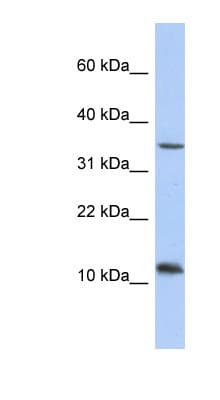 NXNL2 Antibody (aa71-101)