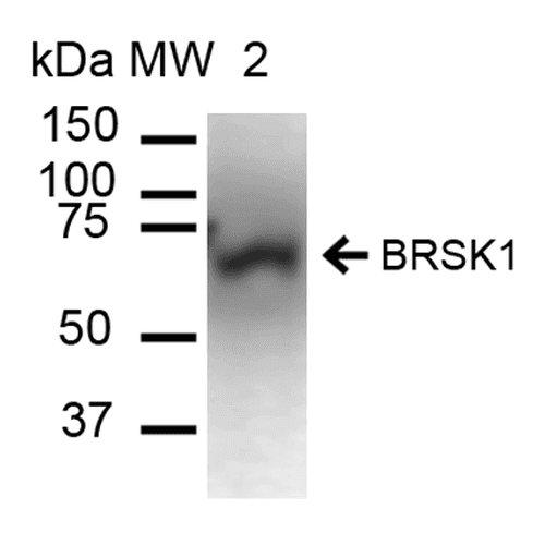 KIAA1811 / BRSK1 Antibody (Atto 390)