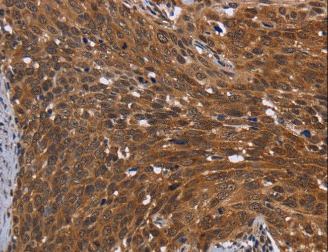 FHIT Antibody