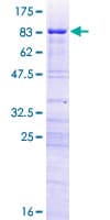 Human RRP8 Protein (Recombinant GST)