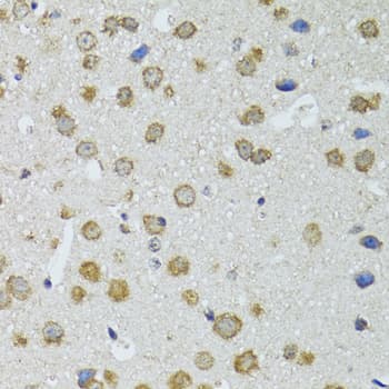 RNASEL / RNase L Antibody
