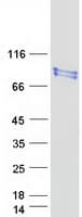 Human RPUSD2 Protein (Recombinant Myc-DDK (Flag))