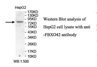 Polyclonal Rabbit anti-Human FBXO42 / JFK Antibody (aa563-717, IHC, WB)