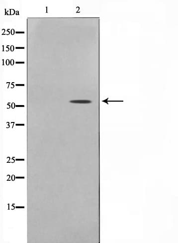 PFKFB1 Antibody