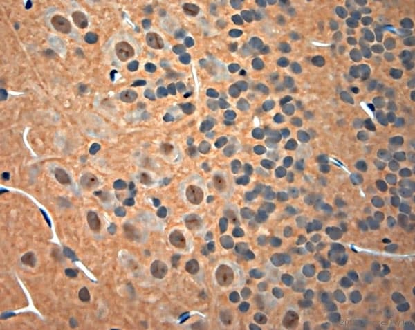 NGF Antibody (aa130-180)