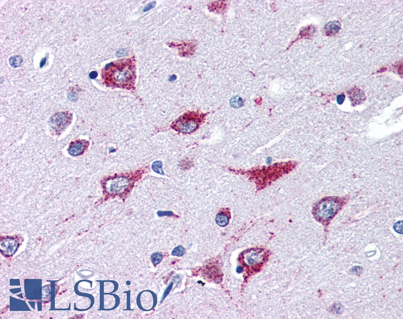 IHC-plus™ ALS2 / Alsin Antibody (aa1644-1657)