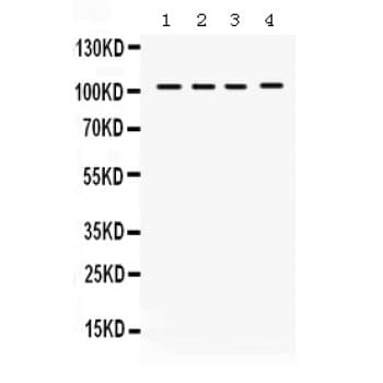 HDAC7 Antibody (aa68-103)
