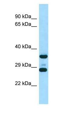 RPS6 / Ribosomal Protein S6 Antibody (aa164-213)