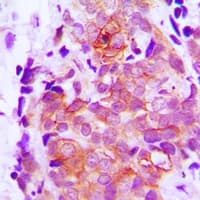 Polyclonal Rabbit anti-Human CLDN7 / Claudin 7 Antibody (C-Terminus, IHC, WB)